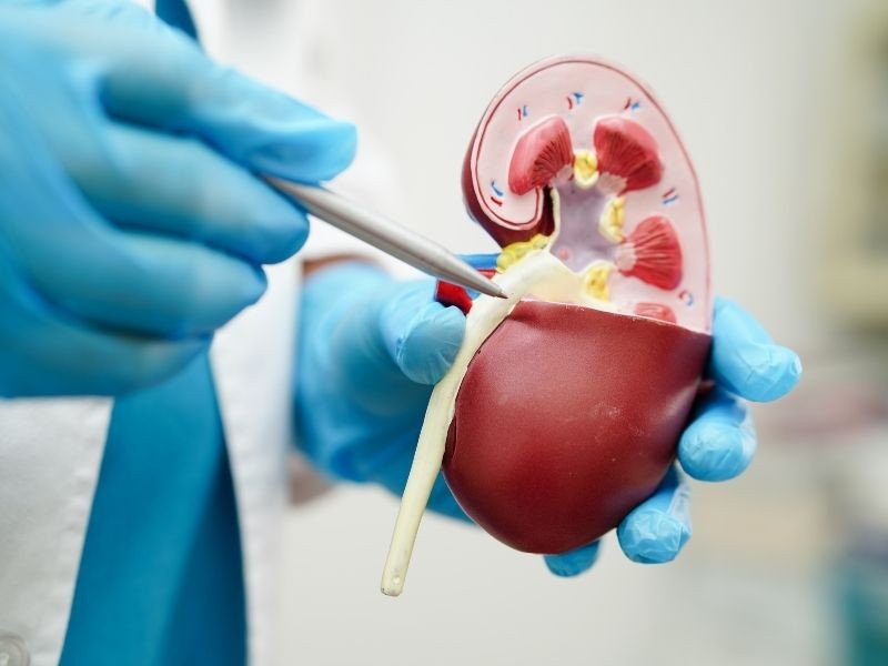 Tratamento Câncer de Pelve Renal